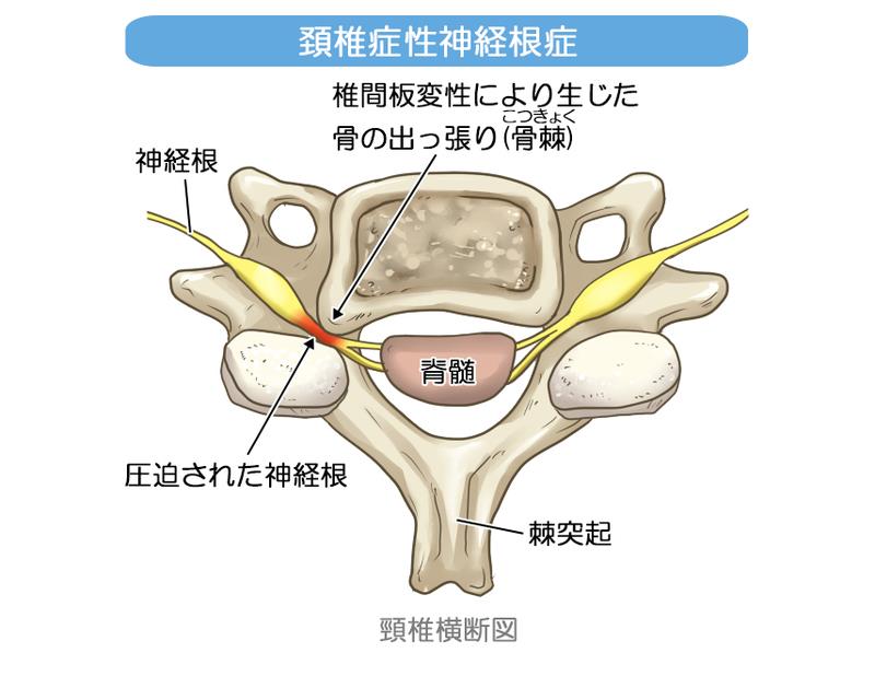 頚椎横断図